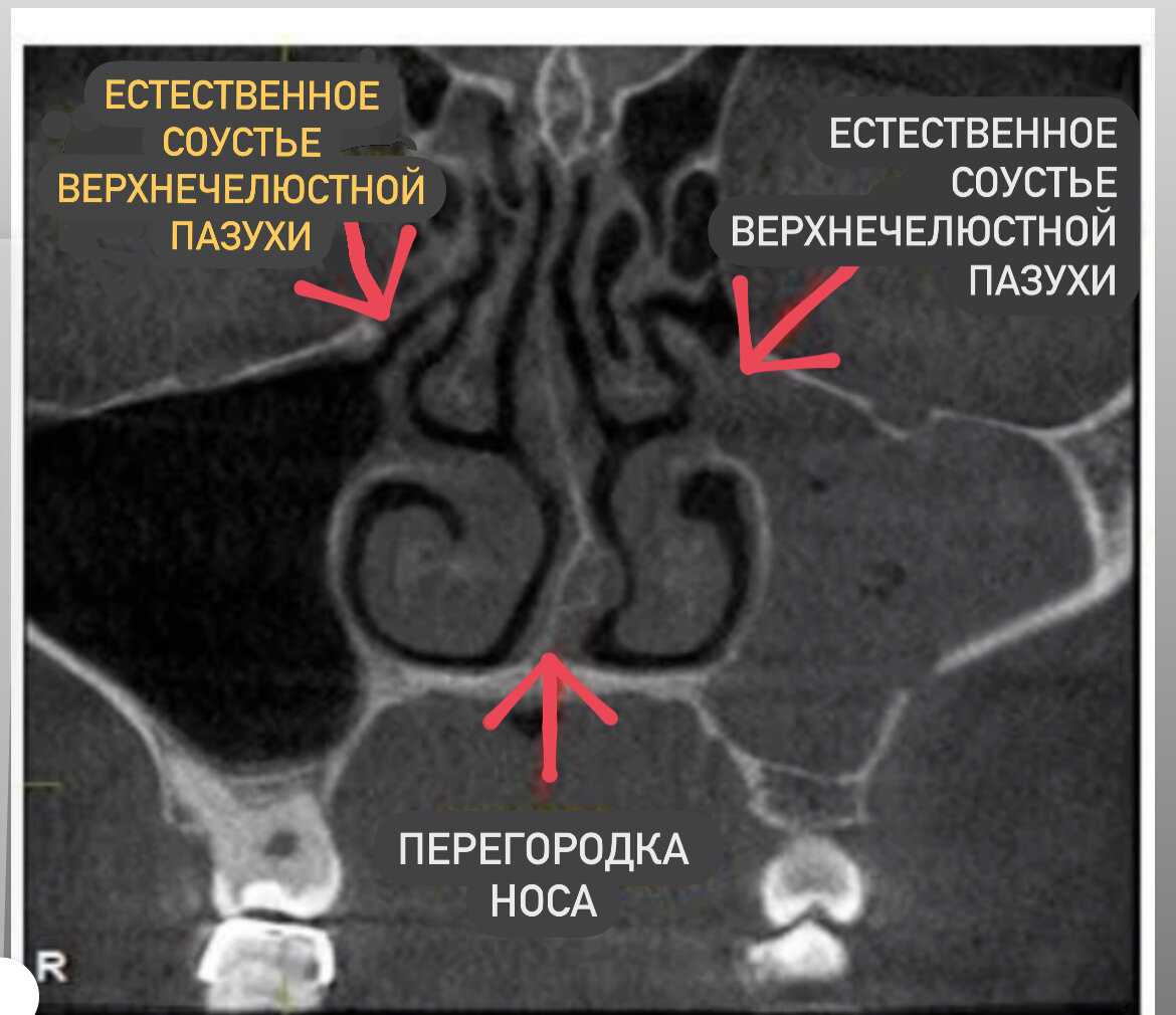 Соустье