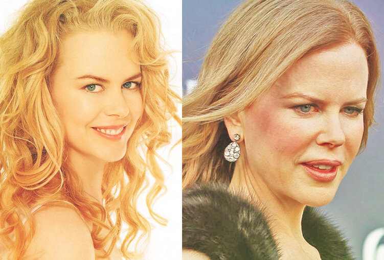 Все люди становятся старше, а когда видишь их редко, эти изменения очень заметны