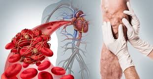 вот как ужасно они выглядят.