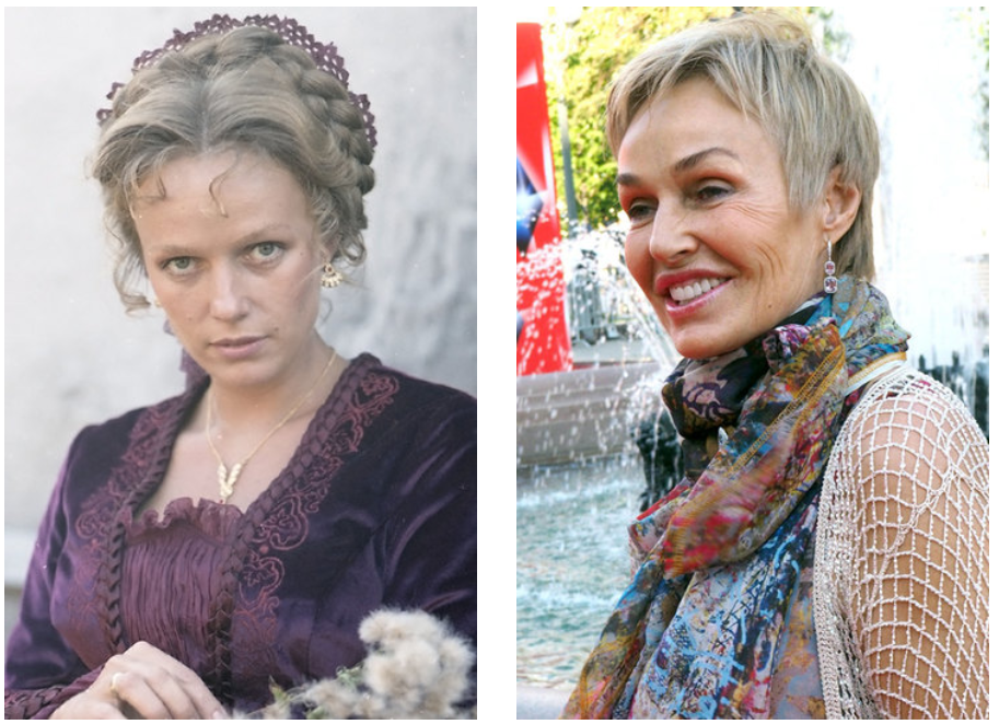 Наталья Андрейченко: до и после пластики