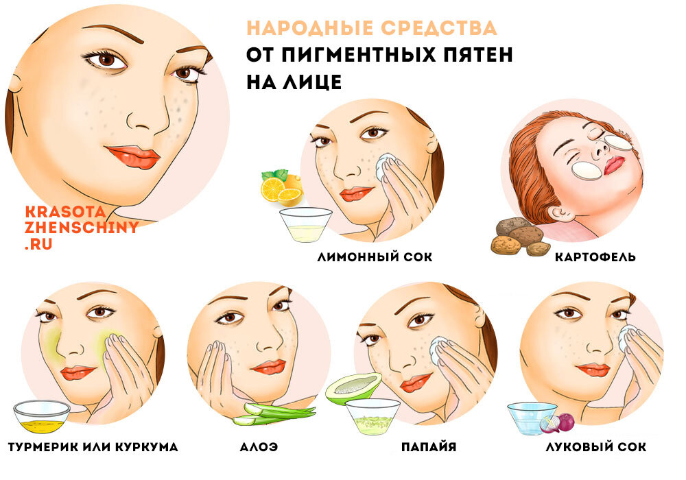 Как избавиться от пигментных пятен на лице - советы специалистов.