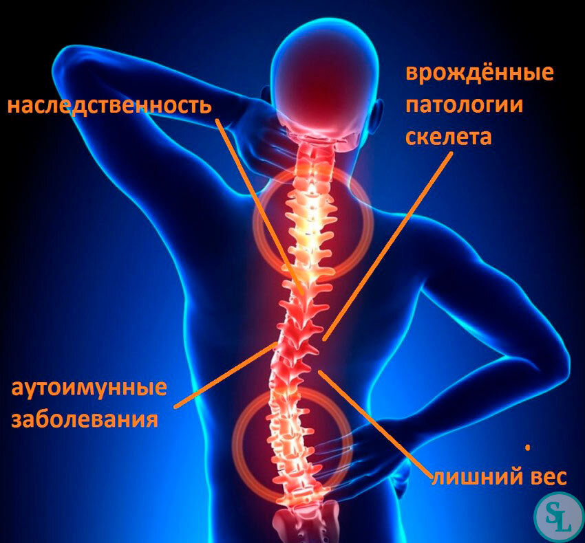 Одни из причин болей в спине и лопатках