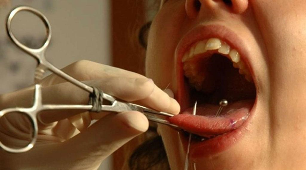 Так выглядит процесс прокола языка. Фото: Яндекс.Картинки