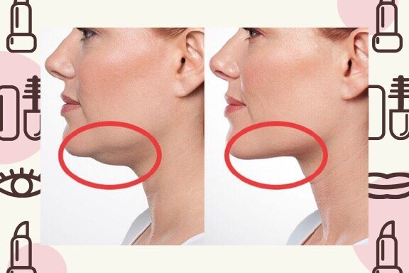 Picture №1 (yandex.ru)