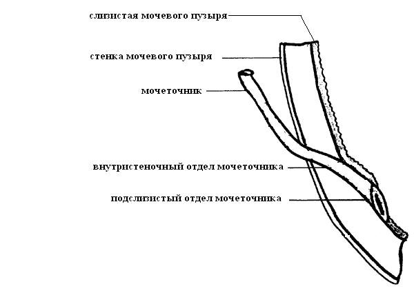 Мочеточнико-пузырный сегмент