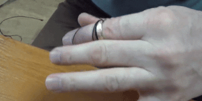 Как снять кольцо с опухшего пальца видео. Кольцо с опухшего пальца с ниткой. Припухлость на пальце руки. Распилить кольцо на пальце.