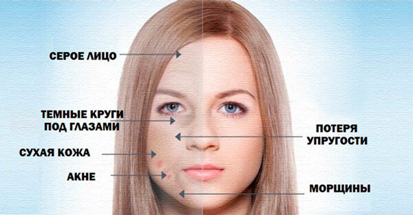 Сигарета губит красоту и здоровье