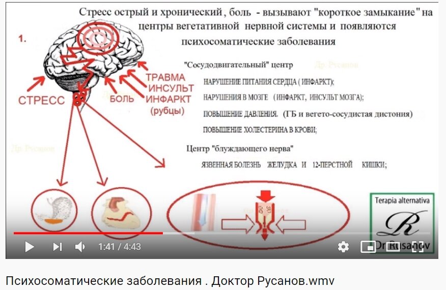 Вегето-сосудистая дистония (ВСД)