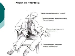 Симптомы и признаки