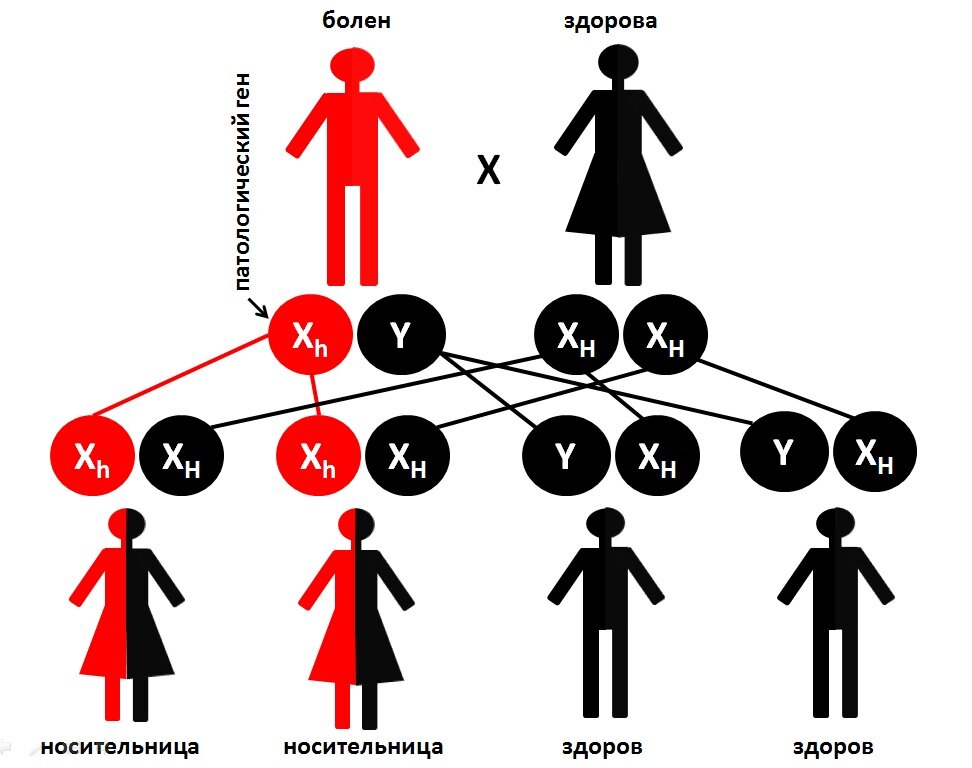Схема наследования гемофилии у человека