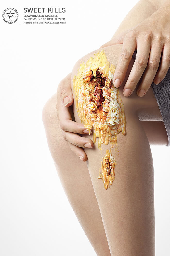 Источник фото: http://everydaydiabetes.com/sweet-kills-campaign/ 