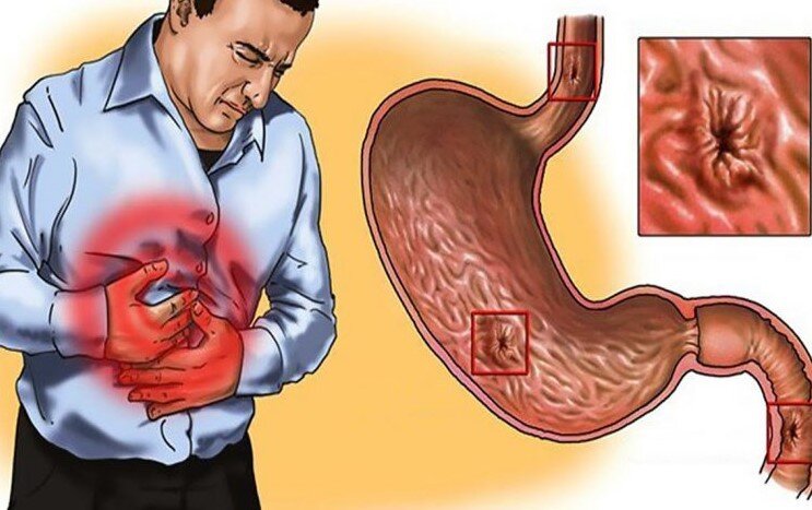 источник Яндекс картинки