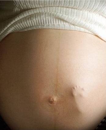 Нормы шевеления плода на каждой неделе беременности