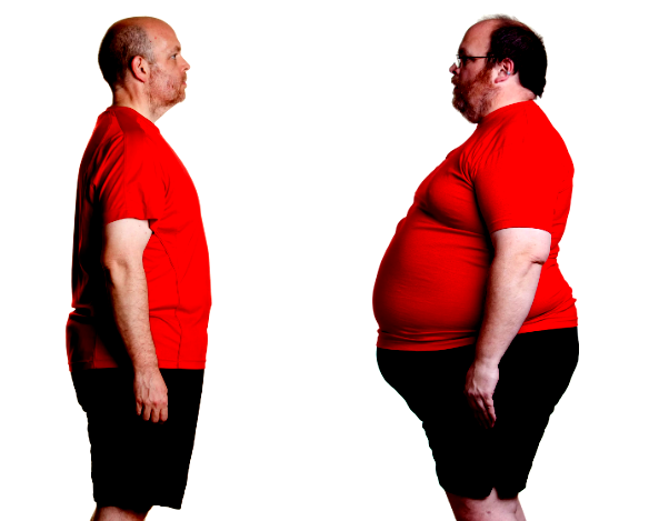 большой живот