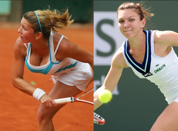 До и после операции спортсменки Симоны Халеп (27.09.1991 д.р.) 