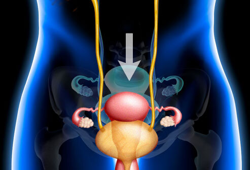 Опущение органов малого таза.