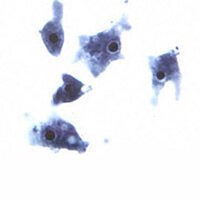 Naegleria trophA 