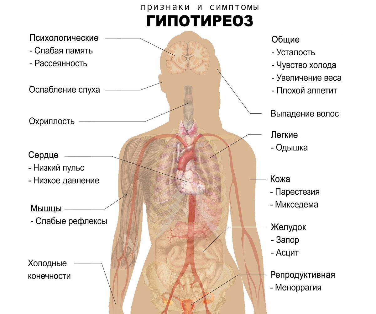 Посмотрите какие еще проблемы с организмом могут возникнуть при гипотиреозе