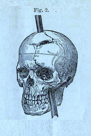Именно таким образом штырь пронзил голову Гейджа