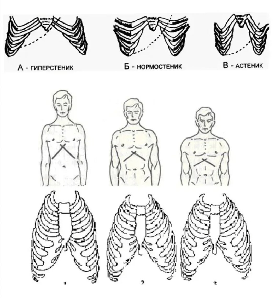 критерии осмотра грудной клетки. формы грудной клетки в норме и патологии у детей. гипостеническая грудная клетка. осмотр грудной клетки пропедевтика алгоритм. гиперстенический тип грудной клетки.