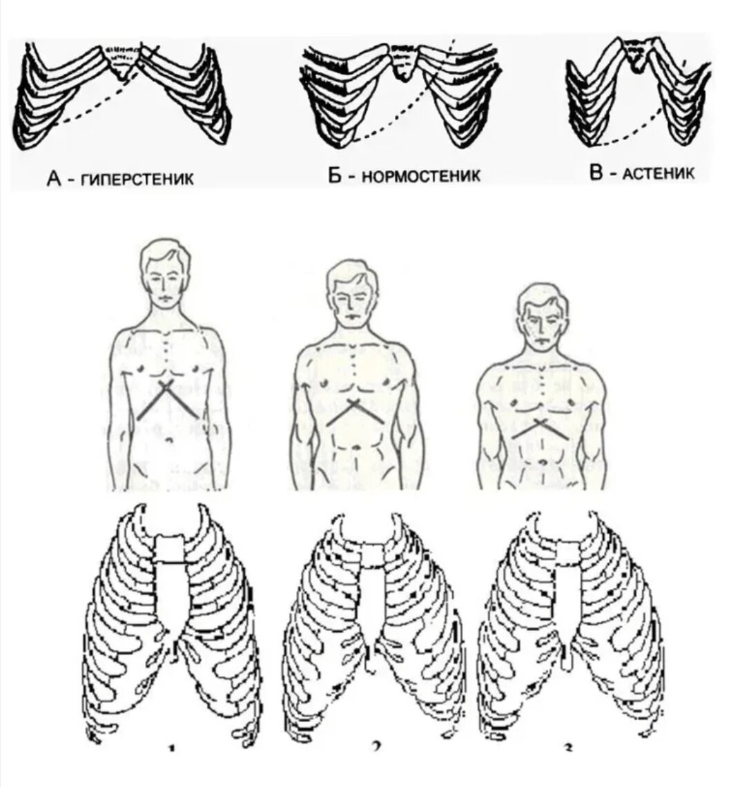 Типы грудной клетки. Форма грудной клетки у астеников. Нормостеническая форма грудной клетки. Нормостенический Тип грудной клетки. Гиперстенический Тип грудной клетки.