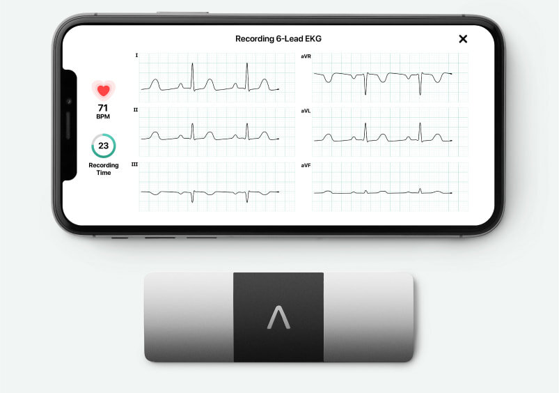 AliveCor выводит на рынок свой мобильный шестиканальный ЭКГ-прибор