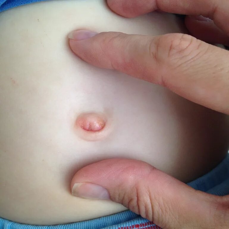 Фото из открытых источников, но у нас выглядит похоже.