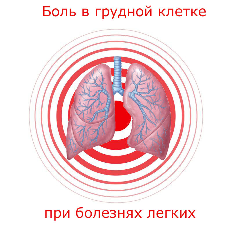 Боли в грудной клетке по ночам. Жжение и боль в грудной клетке: посередине, в левой, правой части – что. Упал на спину, болит грудная клетка: причины, диагностика. Боль в грудной клетке посередине: причины ноющей и острой у женщин