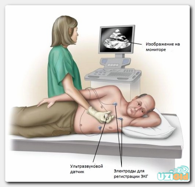 Эх экг. Трансторакальная допплер эхокардиография. УЗИ сердца трансторакальное что это. Эхокардиография методика проведения. Ультразвуковой датчик пригодный для Эхо кг.