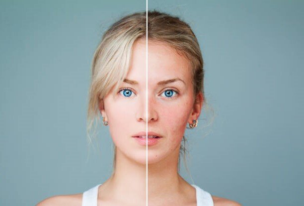 Как вернуть гормоны к балансу?