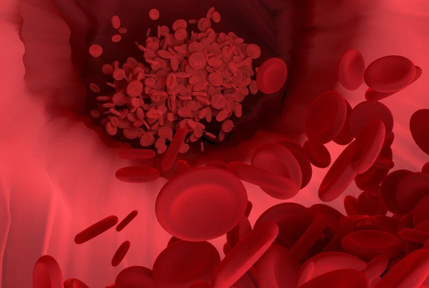 Фото: pixabay.com