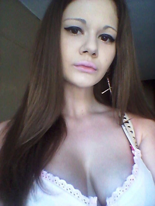 Андреа до увеличения губ