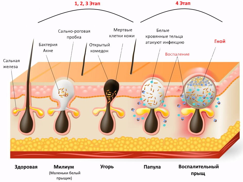 Для тех кто лучше воспринимает визуально