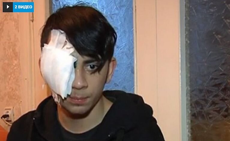 Эдгару Горбаню 13 января 200 года выбили глаз. Фото: YouTube
