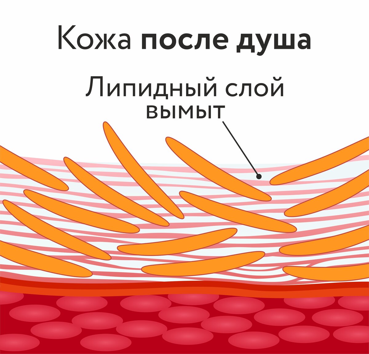 Кожа после приема душа