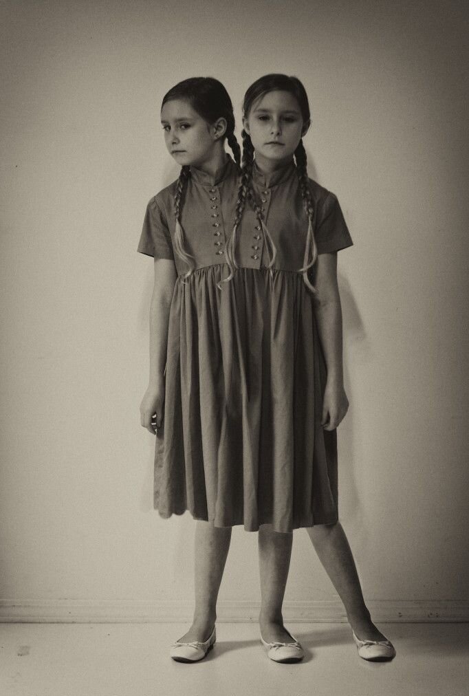 Сиамские близнецы