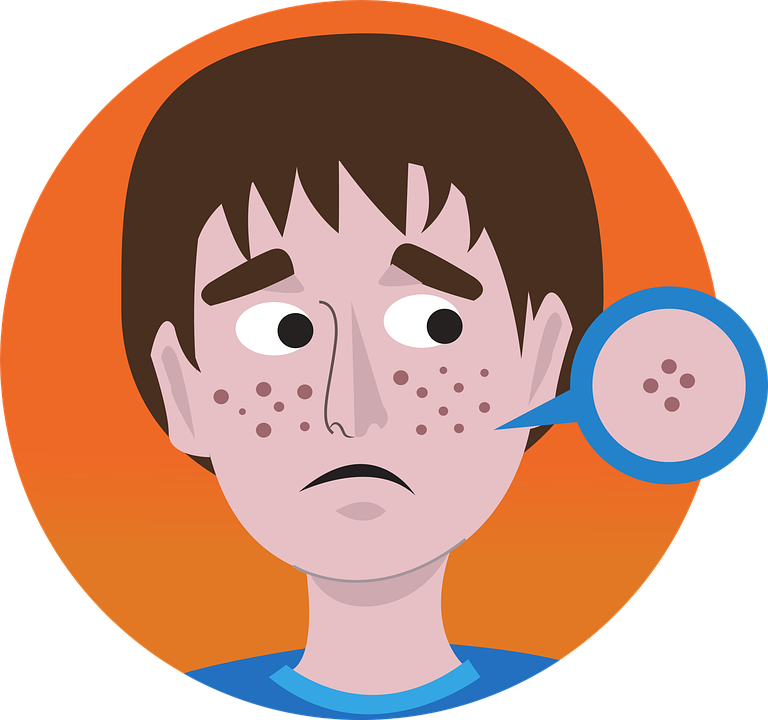 https://pixabay.com/ru/illustrations/acne-%D0%BB%D0%B8%D1%86%D0%BE-%D0%B0%D0%BA%D0%BD%D0%B5-%D0%BB%D0%B8%D1%86%D0%B5%D0%B2%D0%BE%D0%B9-%D0%BC%D0%BE%D0%BB%D0%BE%D0%B4%D0%BE%D0%B9-4254911/