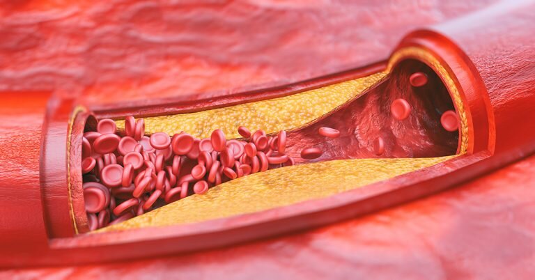                                                                                                         изображение с сайта www.pulsehvvi.com