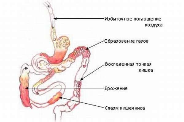 Боли в животе после дефекации