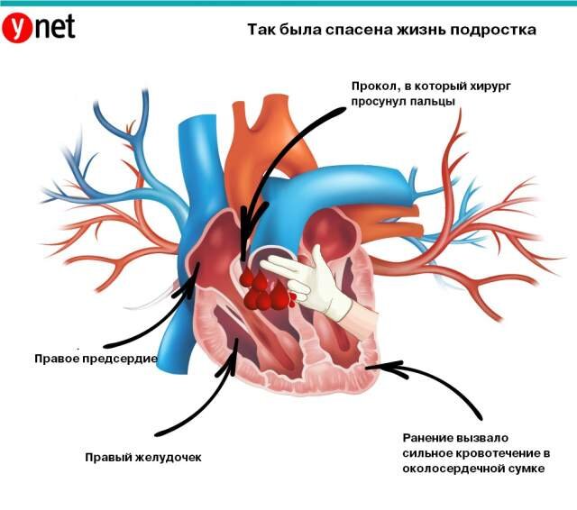 Фото с сайта Ynet
