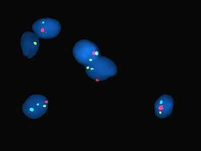 Наличие светящихся меток показывает, как много копий исследуемого гена находится в клетках, и где именно они расположены, в какой последовательности.  Исследованию подвергается сразу сотни сперматозоидов. 
