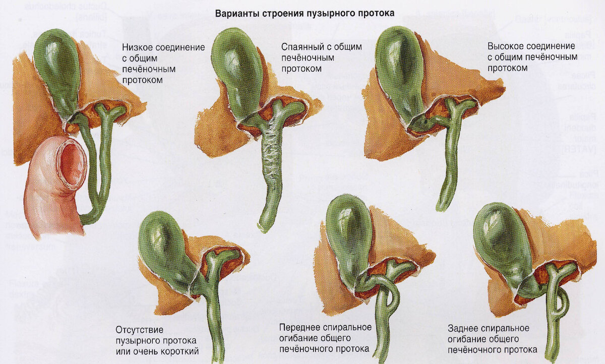 Дискинезия желчного пузыря