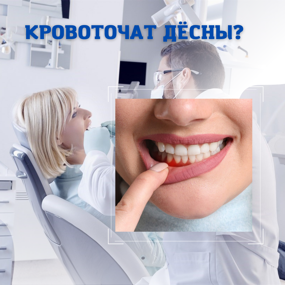 Вам не хватает витамина С