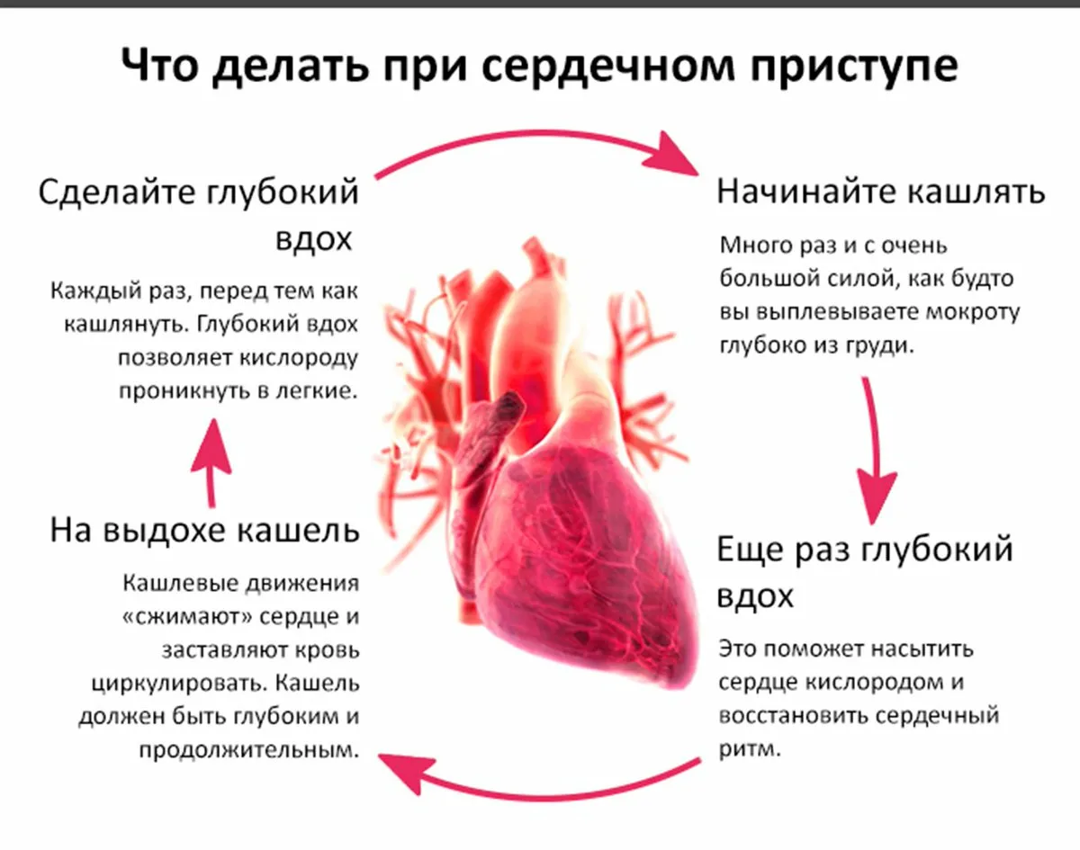 инфаркт после оргазма фото 39