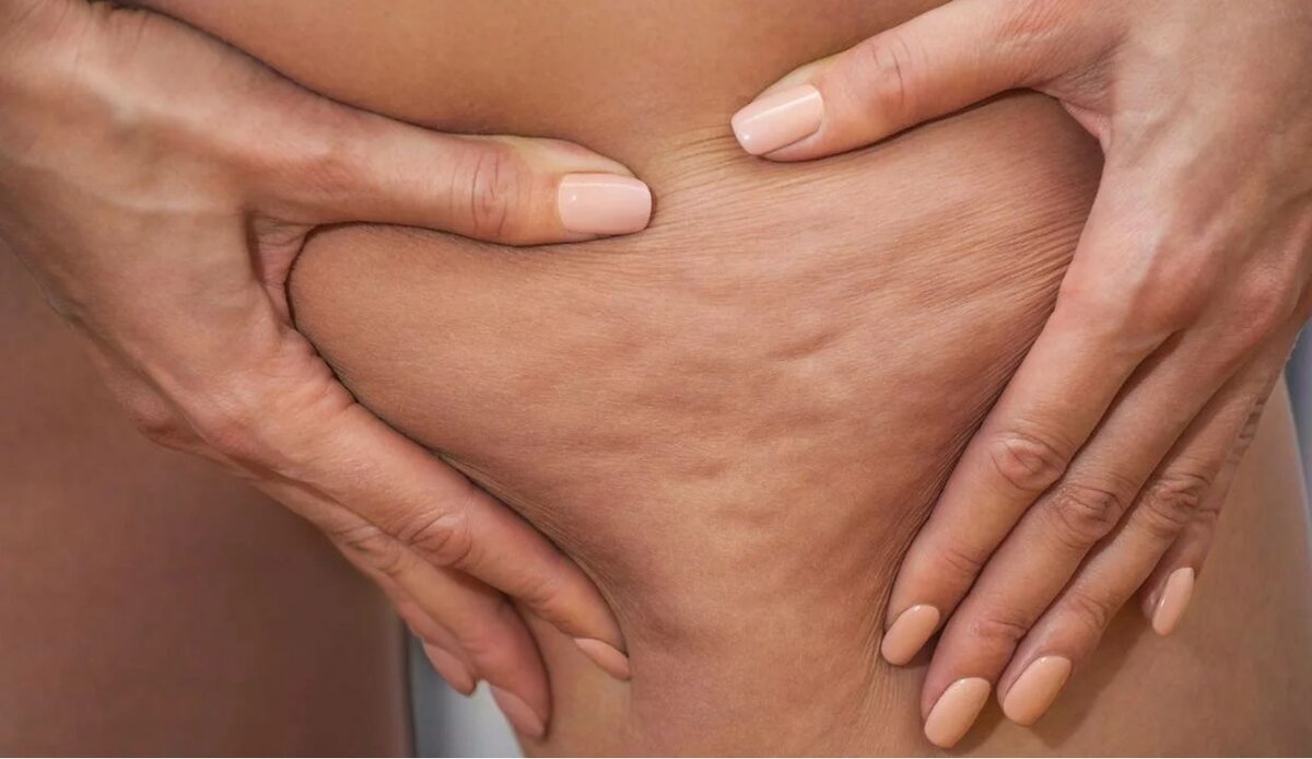 Фото взято в качестве иллюстрации у Яндекс-картинки 