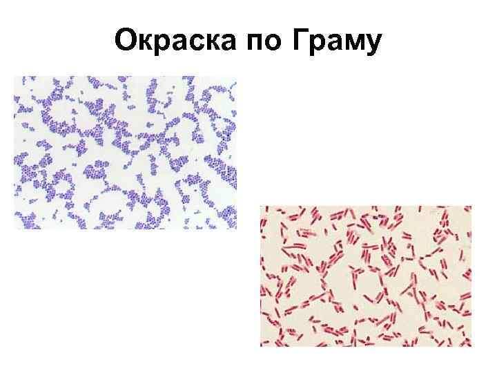 Окраска по технике Грама. Источник фото: https://present5.com/presentation/-42706737_217906873/image-47.jpg