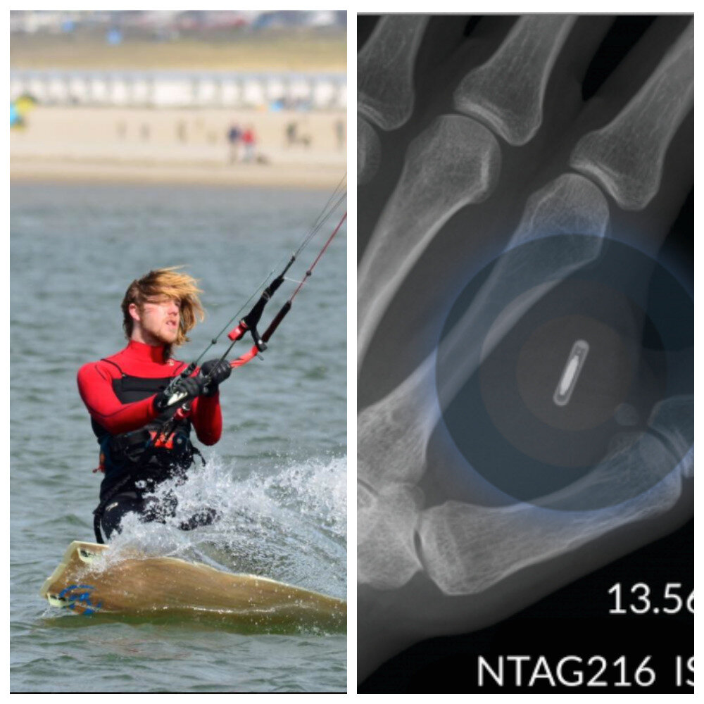 Коллаж: Регина Лутс