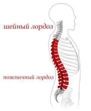 Признаки изменения лордоза