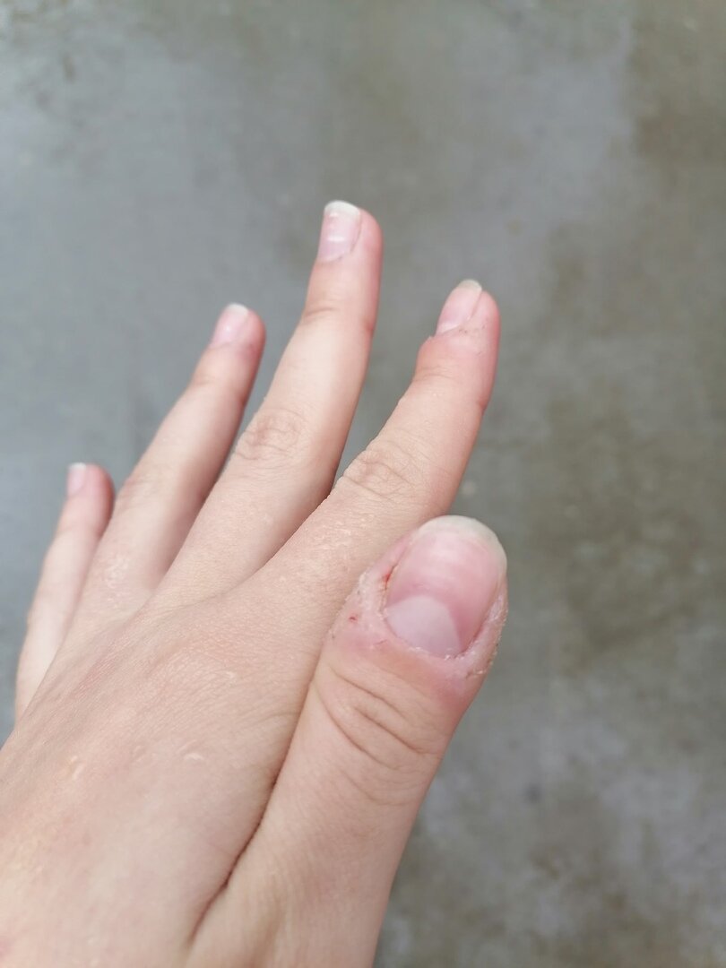 Не так уж и страшно, но поверьте бывало и хуже.