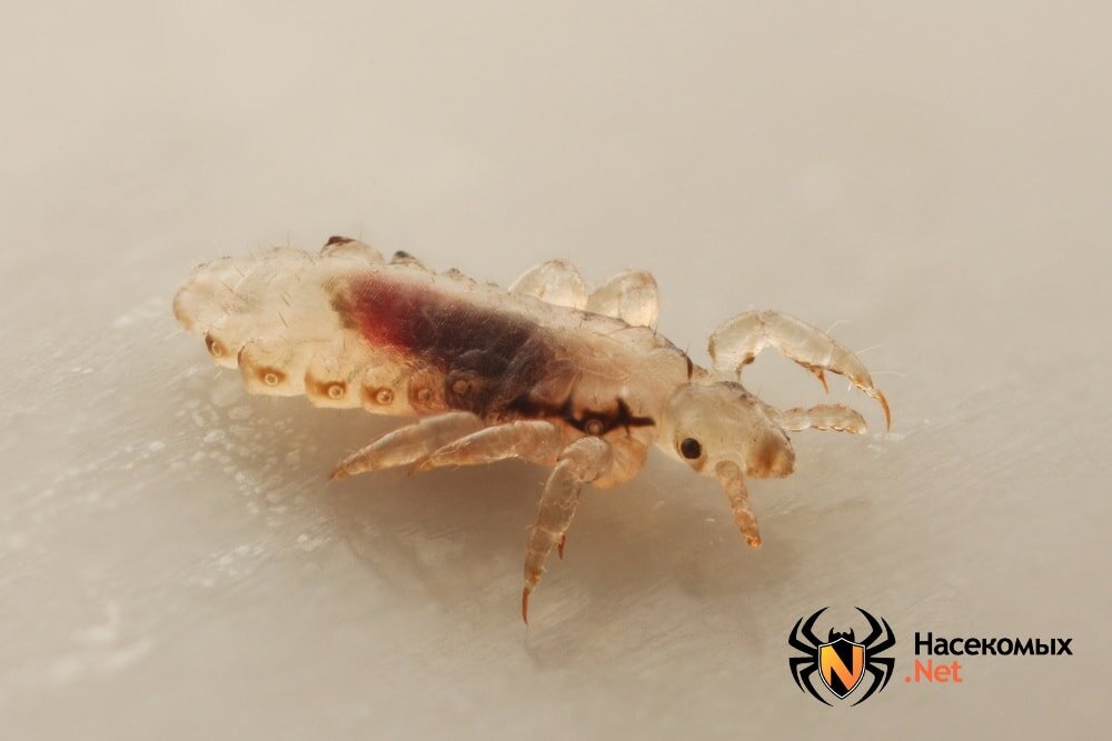 Фото головной вши